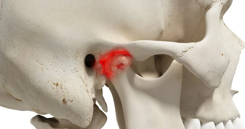 Articulação Temporomandibular (ATM)