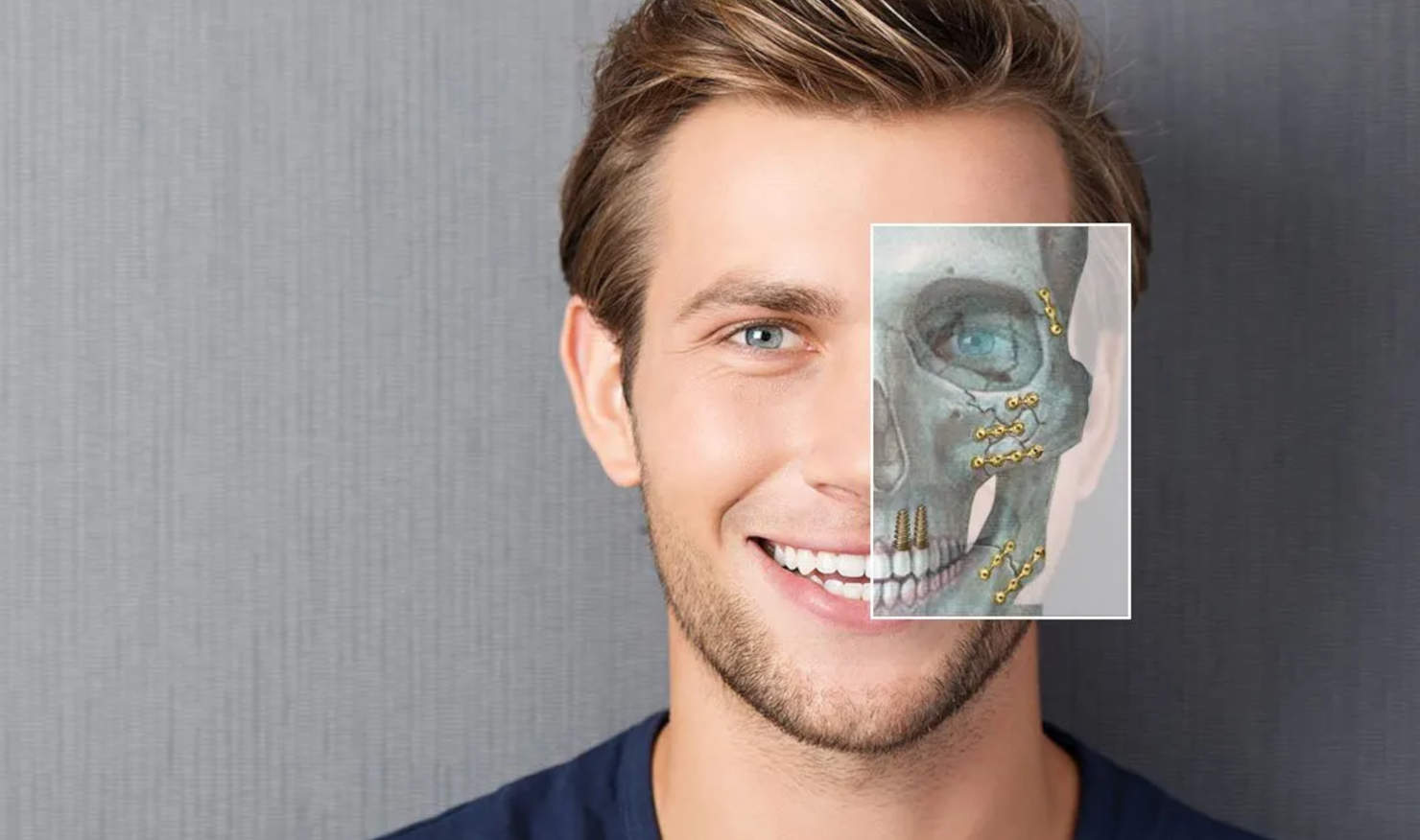 Serviços IOVP - Traumatismo facial